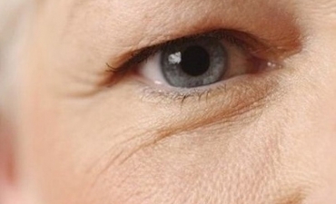 Chăm sóc đôi mắt cho người cao tuổi